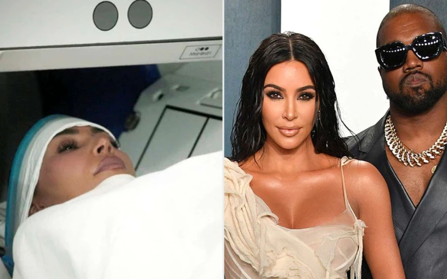 Kim Kardashian Reveals Brain Aneurysm Diagnosis